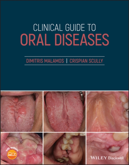 Clinical Guide to Oral Diseases, EPUB eBook