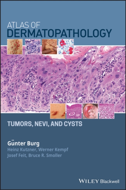 Atlas of Dermatopathology : Tumors, Nevi, and Cysts, EPUB eBook