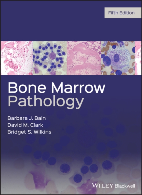 Bone Marrow Pathology, PDF eBook