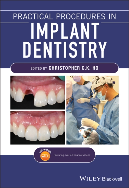 Practical Procedures in Implant Dentistry, Paperback / softback Book