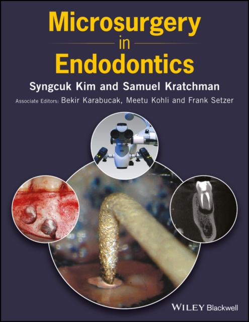 Microsurgery in Endodontics, PDF eBook