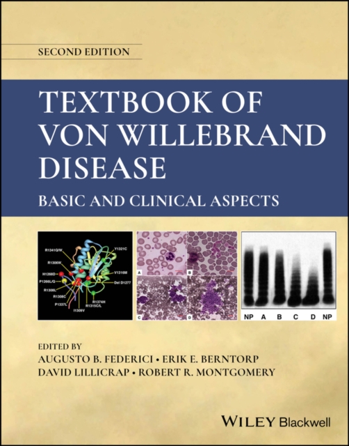 Textbook of Von Willebrand Disease : Basic and Clinical Aspects, EPUB eBook