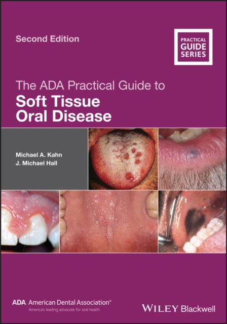 The ADA Practical Guide to Soft Tissue Oral Disease, Paperback / softback Book