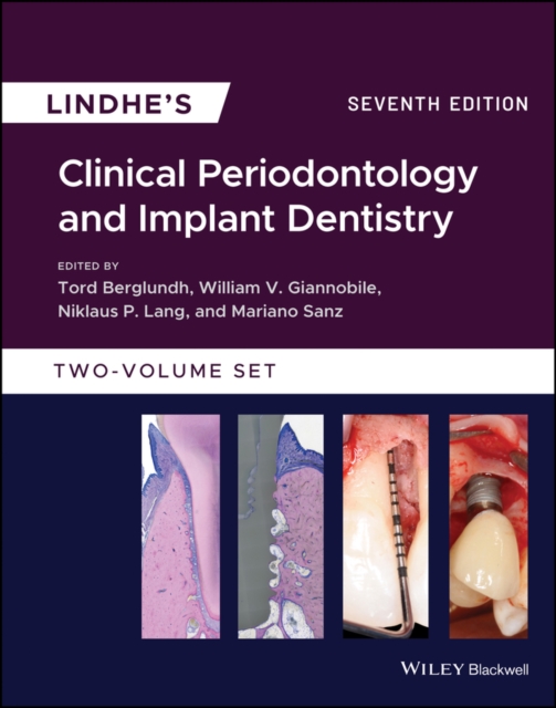 Lindhe's Clinical Periodontology and Implant Dentistry, PDF eBook
