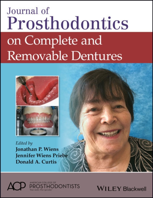 Journal of Prosthodontics on Complete and Removable Dentures, PDF eBook