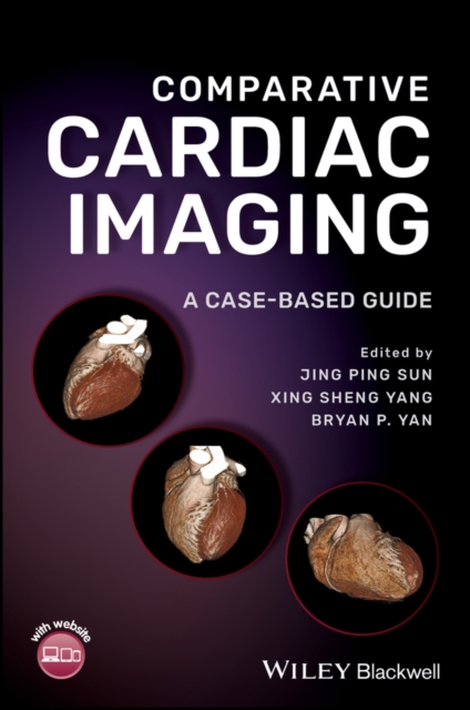 Comparative Cardiac Imaging : A Case-based Guide, PDF eBook