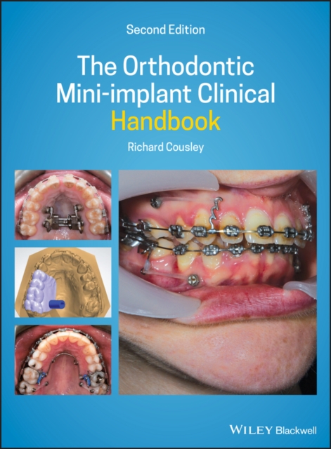 The Orthodontic Mini-implant Clinical Handbook, EPUB eBook