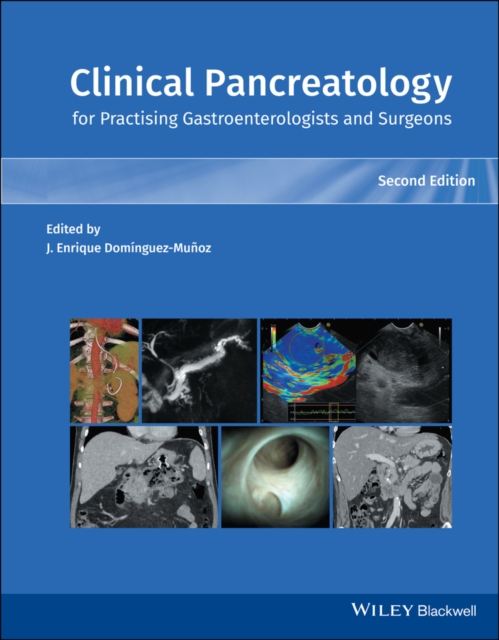 Clinical Pancreatology for Practising Gastroenterologists and Surgeons, Hardback Book