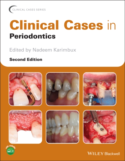 Clinical Cases in Periodontics, Paperback / softback Book