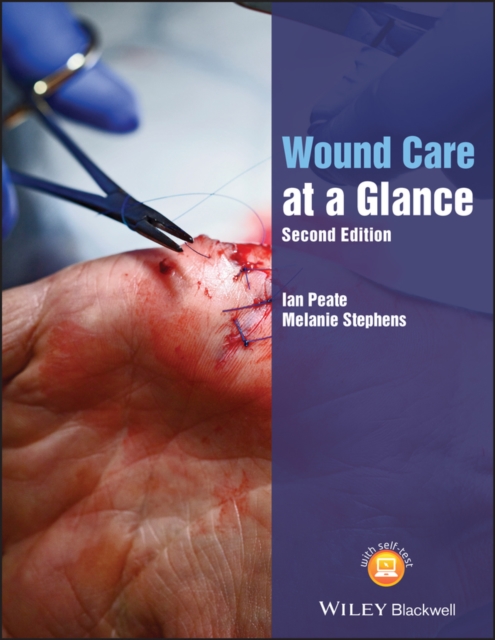 Wound Care at a Glance, Paperback / softback Book