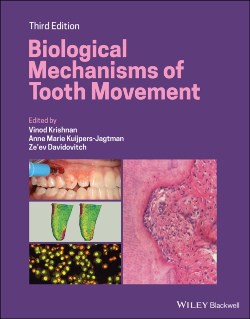 Biological Mechanisms of Tooth Movement, Hardback Book