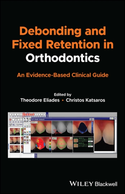 Debonding and Fixed Retention in Orthodontics : An Evidence-Based Clinical Guide, EPUB eBook