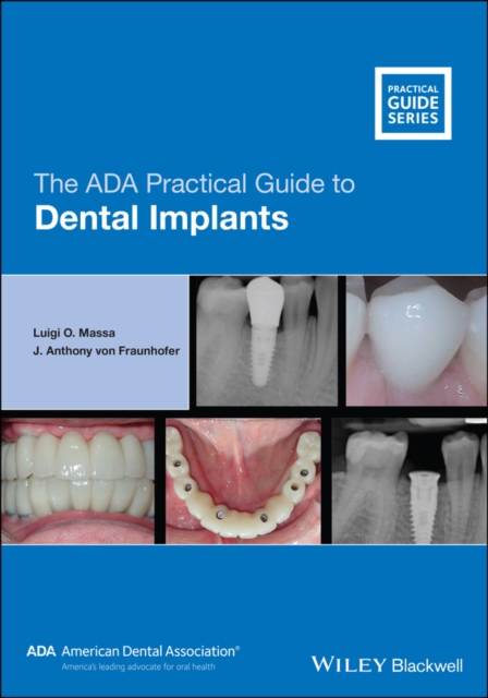 The ADA Practical Guide to Dental Implants, EPUB eBook