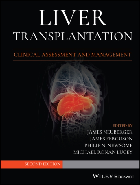 Liver Transplantation : Clinical Assessment and Management, Hardback Book