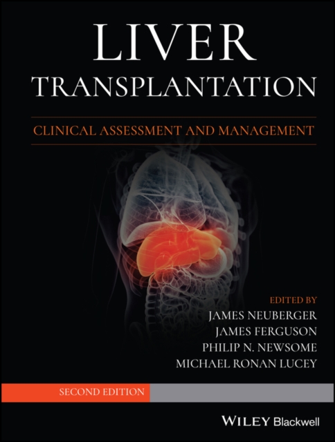 Liver Transplantation : Clinical Assessment and Management, PDF eBook