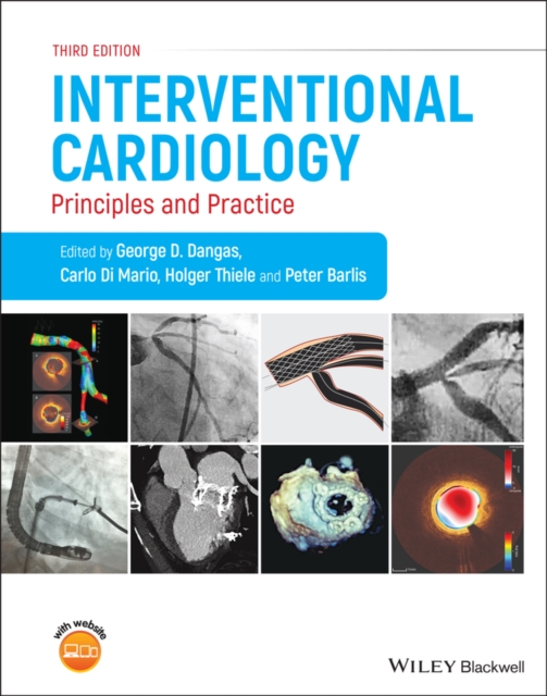 Interventional Cardiology : Principles and Practice, Hardback Book