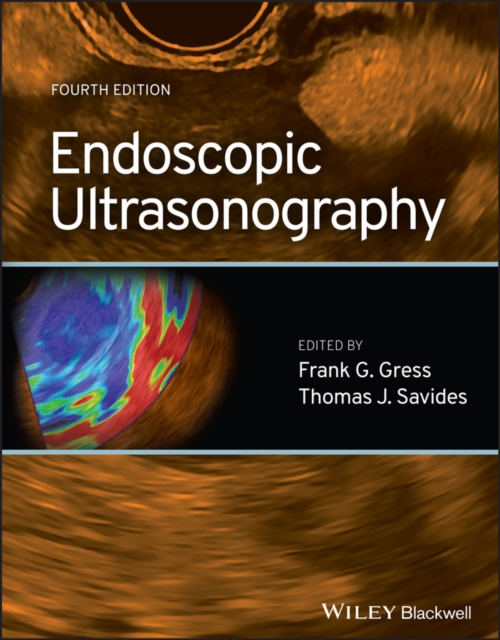 Endoscopic Ultrasonography, EPUB eBook