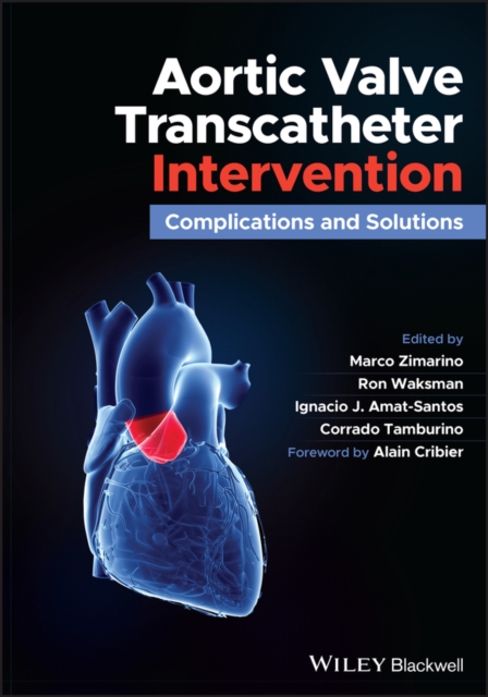Aortic Valve Transcatheter Intervention : Complications and Solutions, EPUB eBook