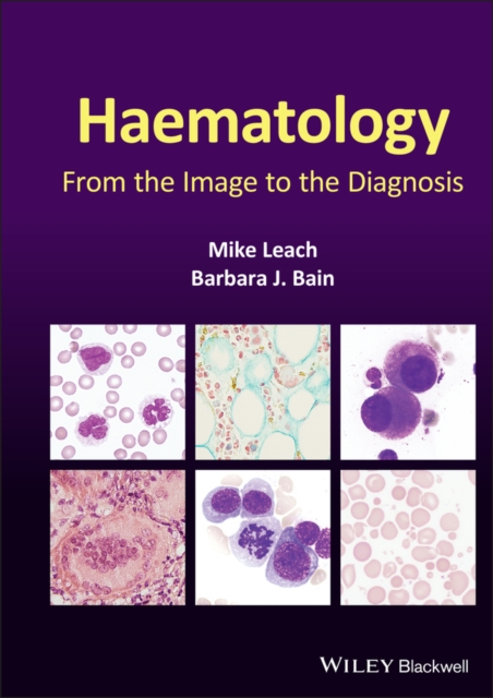 Haematology : From the Image to the Diagnosis, EPUB eBook