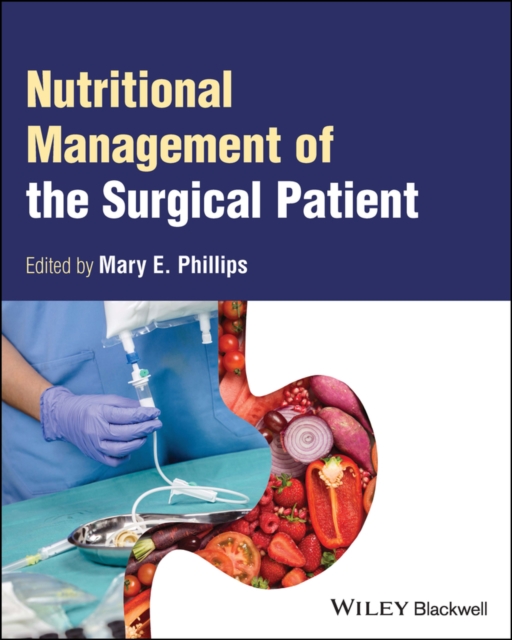 Nutritional Management of the Surgical Patient, Paperback / softback Book