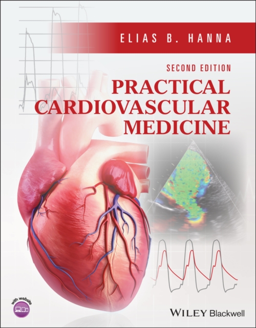Practical Cardiovascular Medicine, PDF eBook