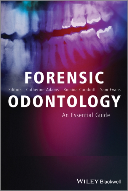 Forensic Odontology : An Essential Guide, Hardback Book
