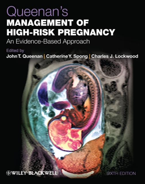 Queenan's Management of High-Risk Pregnancy : An Evidence-Based Approach, EPUB eBook