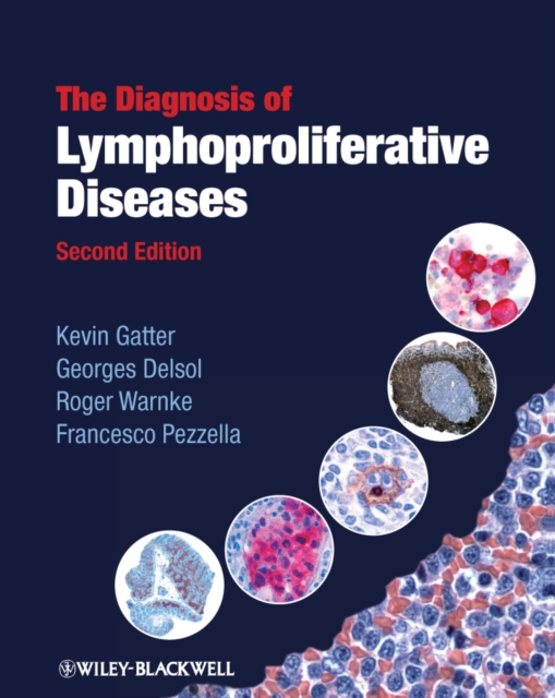 The Diagnosis of Lymphoproliferative Diseases, PDF eBook
