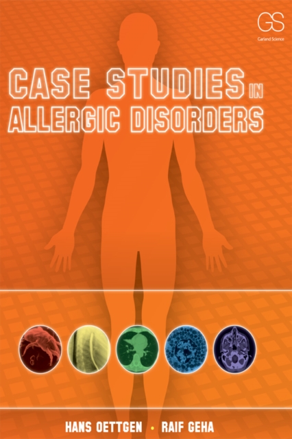 Case Studies in Allergic Disorders, PDF eBook