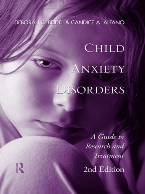 Child Anxiety Disorders : A Guide to Research and Treatment, 2nd Edition, EPUB eBook
