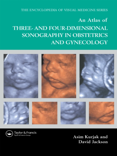 An Atlas of Three- and Four-Dimensional Sonography in Obstetrics and Gynecology, EPUB eBook