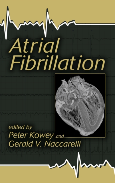 Atrial Fibrillation, EPUB eBook