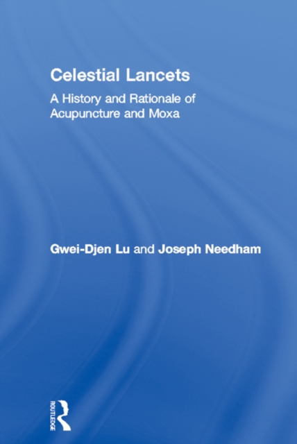 Celestial Lancets : A History and Rationale of Acupuncture and Moxa, EPUB eBook