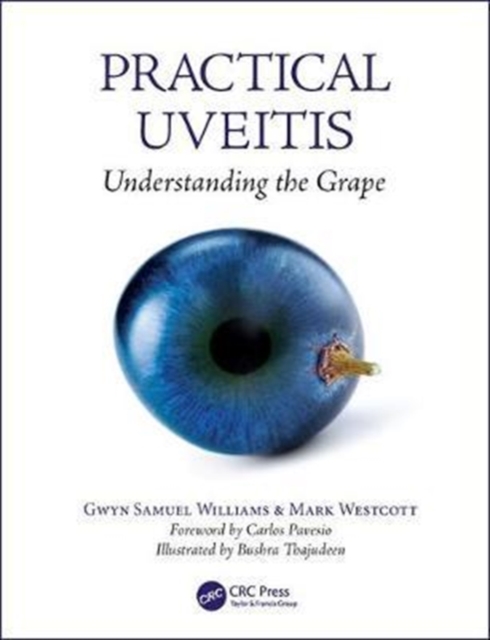 Practical Uveitis : Understanding the Grape, Paperback / softback Book