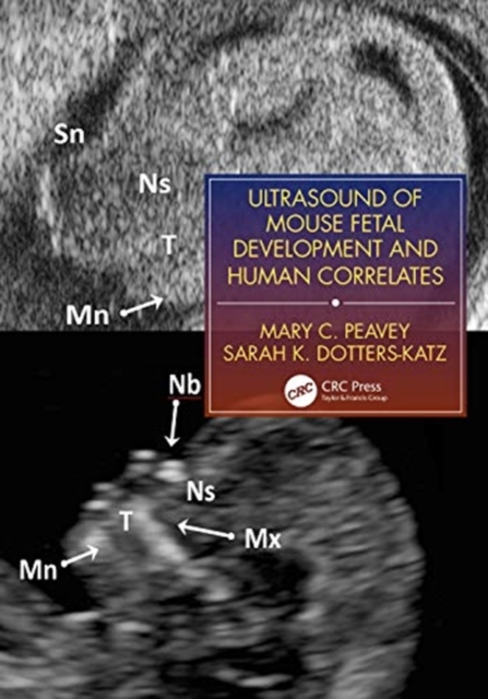 Ultrasound of Mouse Fetal Development and Human Correlates, Paperback / softback Book