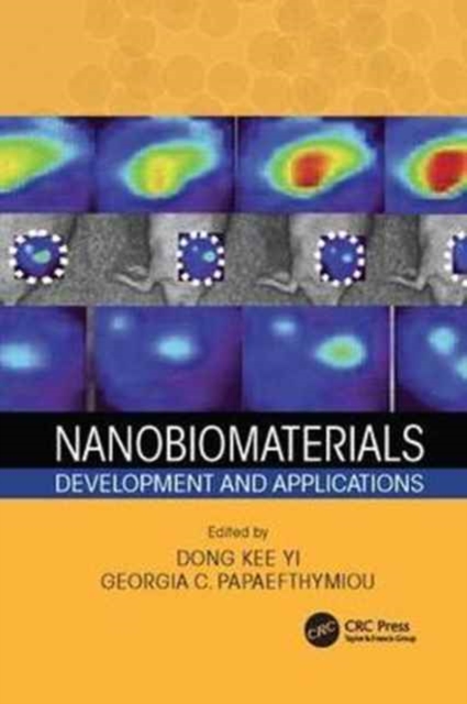 Nanobiomaterials : Development and Applications, Paperback / softback Book