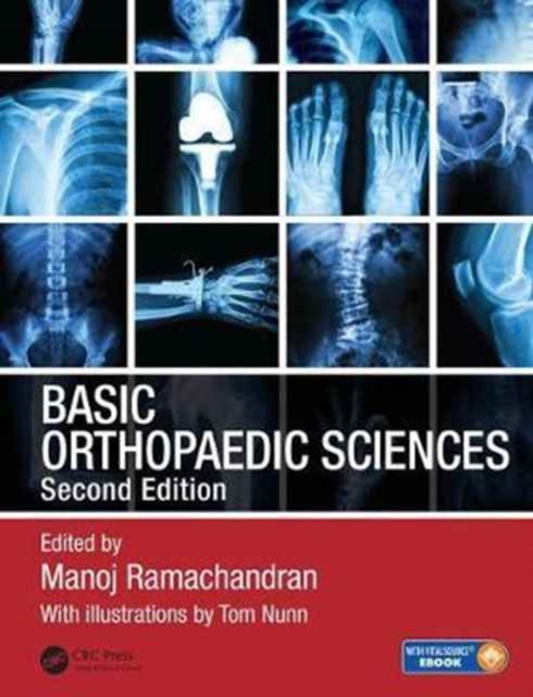 Basic Orthopaedic Sciences, Hardback Book