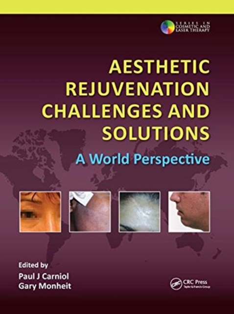 Aesthetic Rejuvenation Challenges and Solutions : A World Perspective, Paperback / softback Book