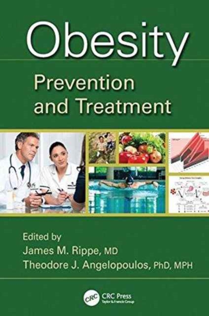 Obesity : Prevention and Treatment, Paperback / softback Book