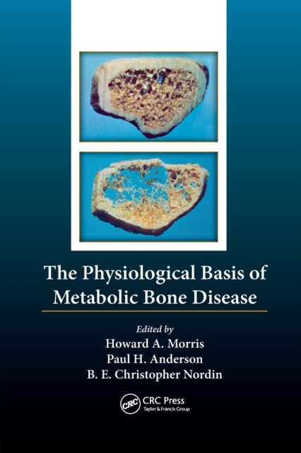 The Physiological Basis of Metabolic Bone Disease, Paperback / softback Book