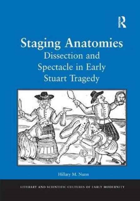Staging Anatomies : Dissection and Spectacle in Early Stuart Tragedy, Paperback / softback Book
