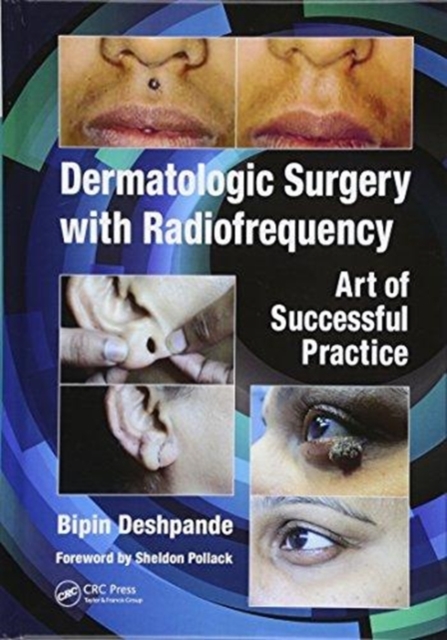 Dermatologic Surgery with Radiofrequency : Art of Successful Practice, Hardback Book