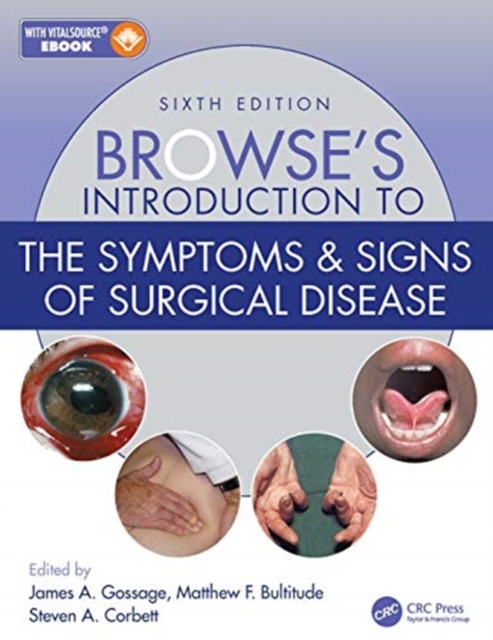 Browse's Introduction to the Symptoms & Signs of Surgical Disease, Paperback / softback Book