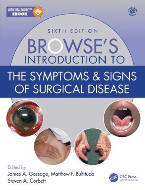 Browse's Introduction to the Symptoms & Signs of Surgical Disease, Hardback Book