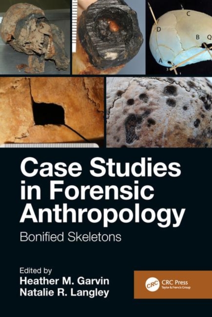 Case Studies in Forensic Anthropology : Bonified Skeletons, Hardback Book