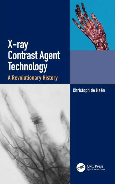 X-ray Contrast Agent Technology : A Revolutionary History, Hardback Book