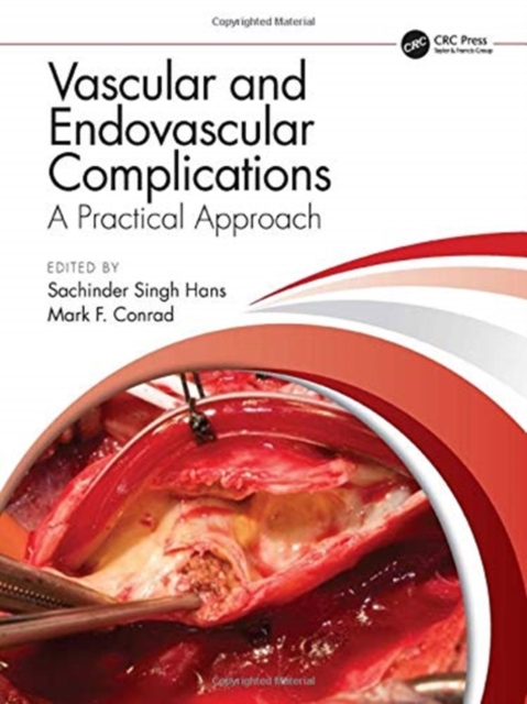 Vascular and Endovascular Complications: A Practical Approach, Hardback Book