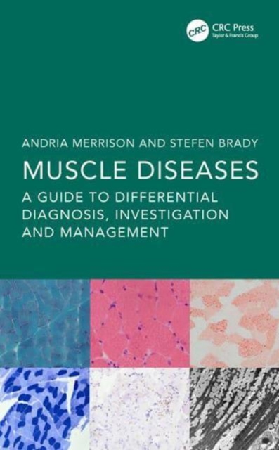 Muscle Diseases : A Guide to Differential diagnosis, investigation and management, Paperback / softback Book