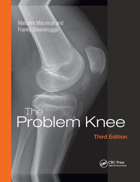 The Problem Knee, Paperback / softback Book