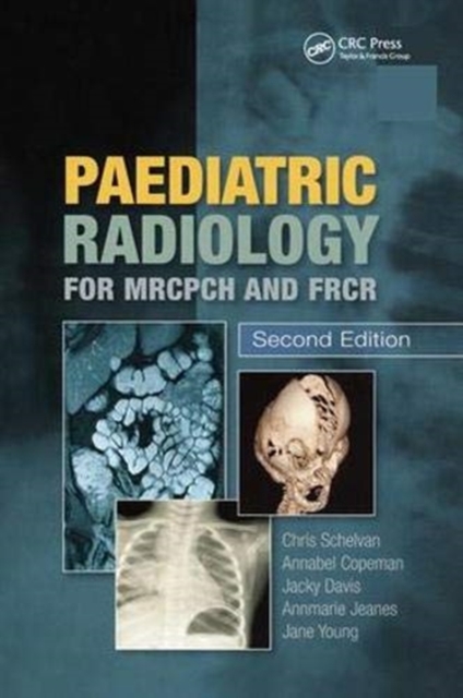 Paediatric Radiology for MRCPCH and FRCR, Second Edition, Hardback Book